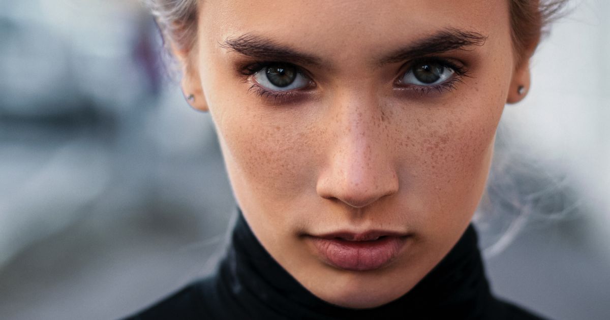 Acne adulta: o que , causas e como lidar com as espinhas