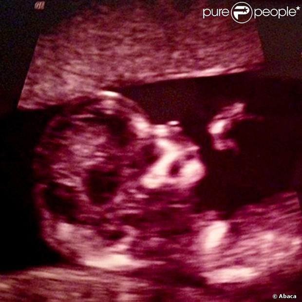 Danielle Jonas e Kevin Jonas vão ter um filho. A mulher do cantor exibiu a primeira imagem do rostinho do bebê em 6 de agosto de 2013