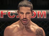 José Loreto aparece com rosto machucado em teaser de filme sobre José Aldo