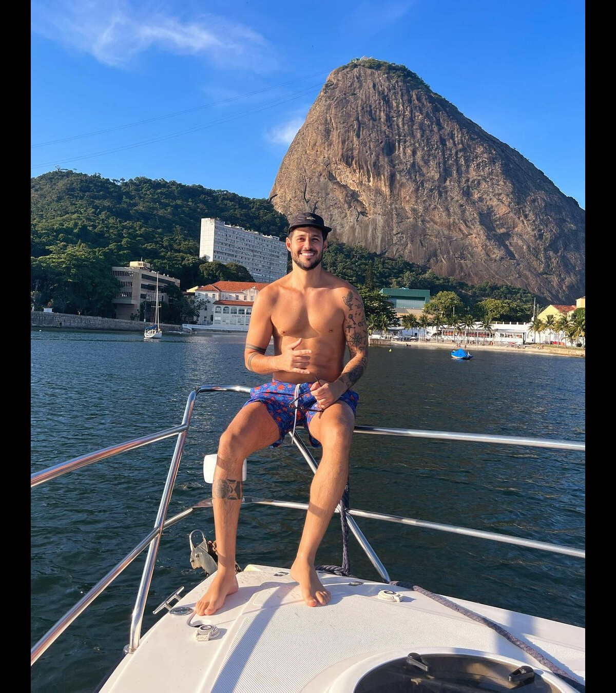 Foto Ex BBB Rodrigo Mussi precisou se submeter a três cirurgias bem