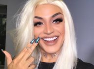 Pabllo Vittar trata infecção e cancela show no Criança Esperança: 'Siso doendo'
