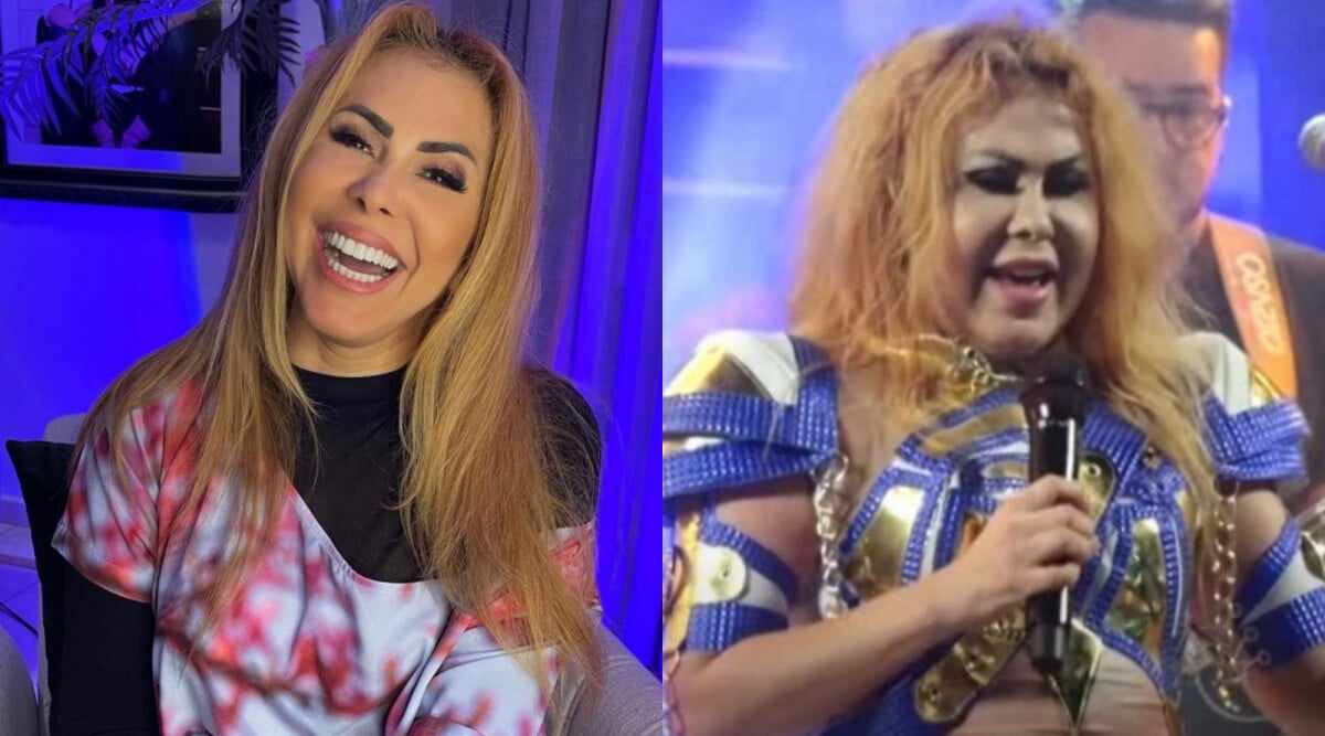 Foto Rosto Inchado De Joelma Choca E Preocupa F S Em Show Purepeople