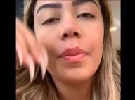 Rafaella Santos exibe resultado de rinoplastia: 'Levantei um pouco'. Vídeo!