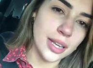 Ex-BBB Vivian surge com rosto inchado após crise alérgica: 'Estou podre'. Vídeo!