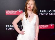 Conheça Madeline Stuart, primeira modelo profissional com Síndrome de Down