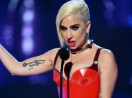 Internautas elogiam Lady Gaga por exibir estria em foto: 'Obrigada por ser real'