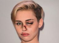 Miley Cyrus e famosas surgem machucadas em campanha contra violência doméstica