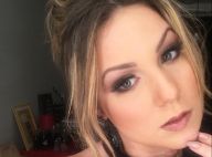 Ex-BBB Cacau passa bem após se submeter a cirurgia estética: 'Deu tudo certo'
