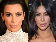 Kim Kardashian, Angelina Jolie e outras famosas fizeram bichectomia. Veja fotos!
