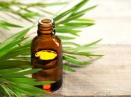 Óleo de melaleuca controla a oleosidade da pele e combate a acne. Veja como!