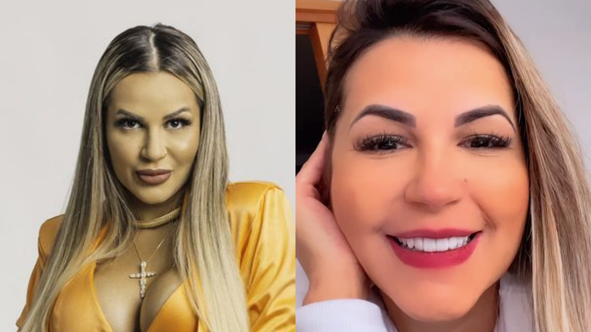 Foto Antes E Depois De Deolane Bezerra Sem Preenchimento Labial