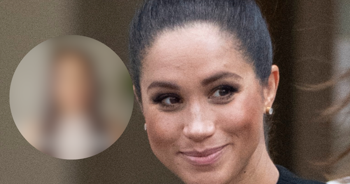 Meghan Markle Fez Cirurgia Pl Stica Rosto Da Mulher De Pr Ncipe Harry