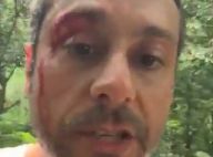 Alexandre Nero exibe 'ferida' em cena de 'A Regra do Jogo': 'Romero sangrando'