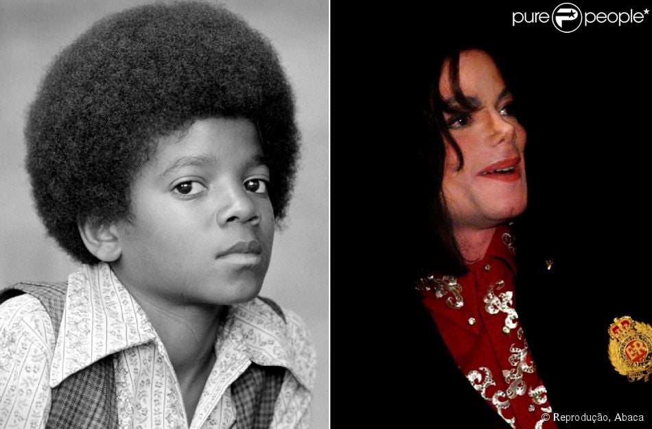 A primeira cirurgia feita por Michael Jackson foi no nariz. De acordo com a mãe do cantor, Katherine, ela até tentou convencê-lo a não fazer, mas o filho era viciado em plásticas