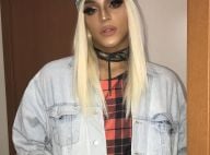 Pabllo Vittar tranquiliza fãs sobre estado de saúde: 'Não sinto mais tanta dor'
