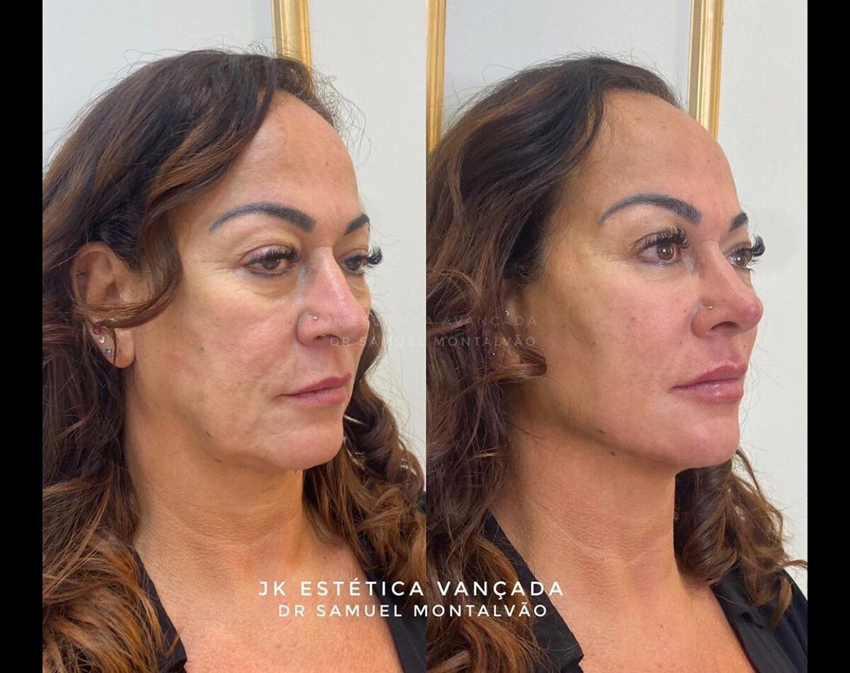 Foto Mãe de Neymar Nadine Gonçalves surpreende antes e depois de