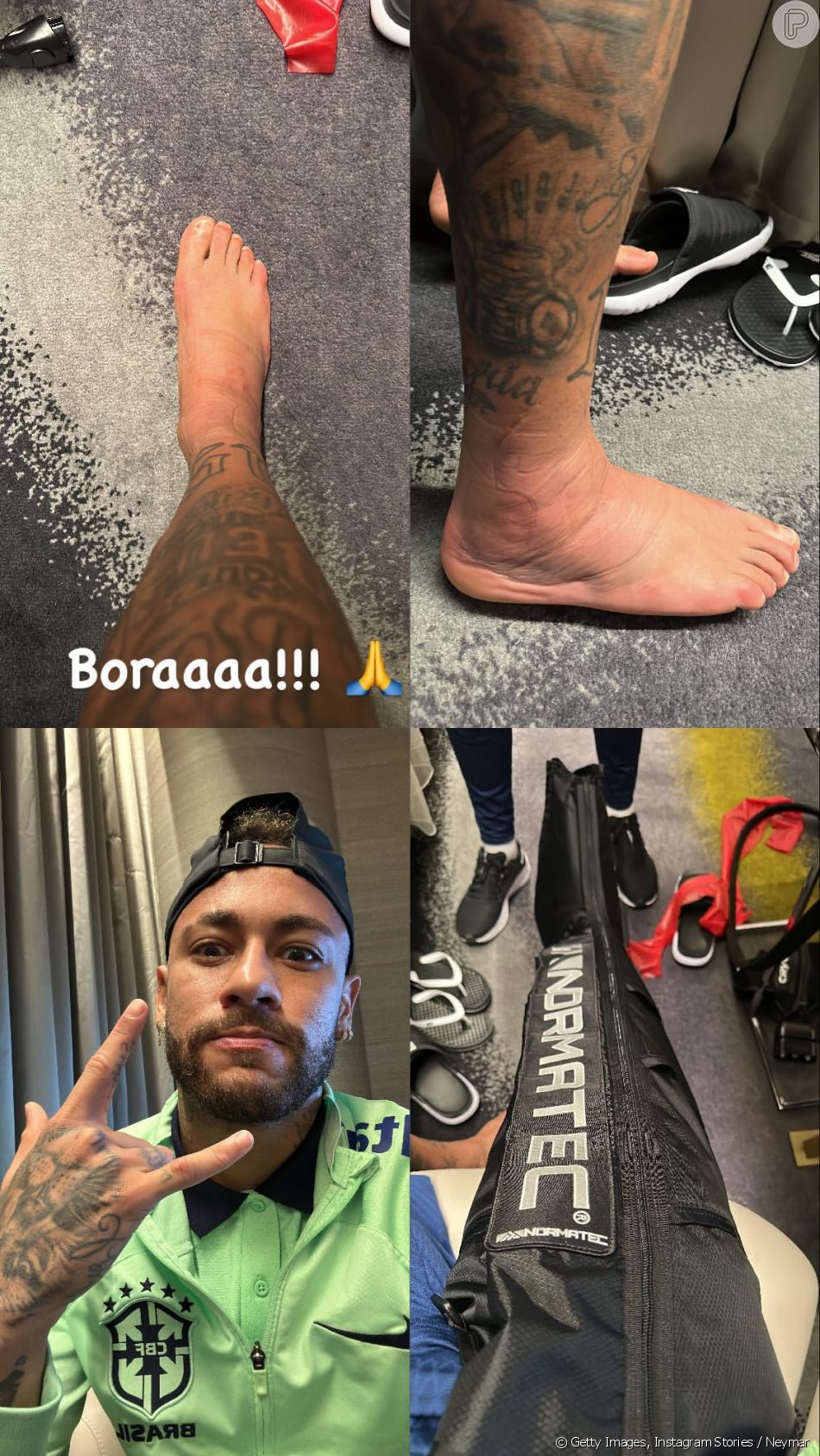 Copa do Mundo 22 Neymar Jr choca a web foto do pé machucado fotos