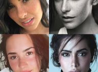 Sardas naturais ou fake? Confira 30 famosas que esbanjam charme com as pintinhas