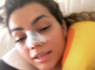 Kelly Key passa por cirurgias plásticas no nariz, seios e costas:'Está tudo bem'