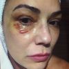 Luiza Brunet foi agredida por Lírio Parisotto no dia 21 de maio de 2016