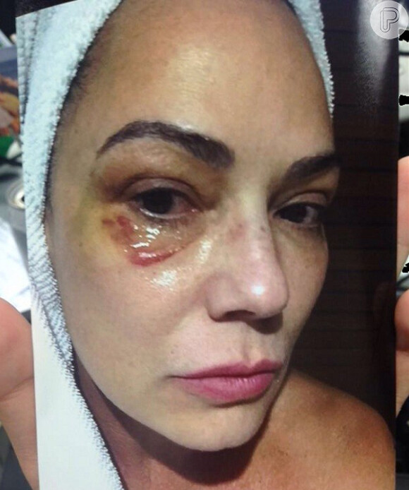 Luiza Brunet foi agredida por Lírio Parisotto no dia 21 de maio de 2016