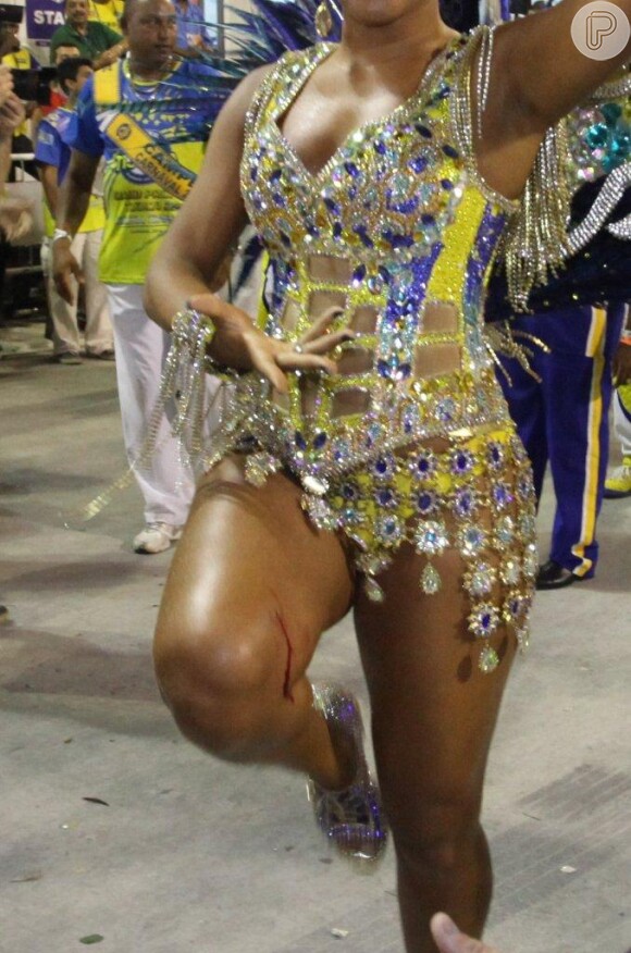 Machucado na perna de Juliana Alves durante desfile da Unidos da Tijuca