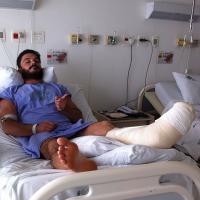 Kiko Pissolato passa por cirurgia para colocar pinos no pé: 'Muletas por meses'