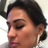 Simone elogia marido, Kaká Diniz, após implante capilar em vídeo nesta terça-feira, dia 03 de julho de 2018
