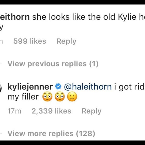 'Eu me livrei de todo o preenchimento labial', assumiu Kylie Jenner no Instagram