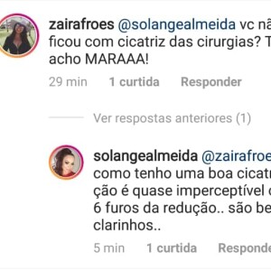 Solange Almeida explica ausência de marcas da cirurgia