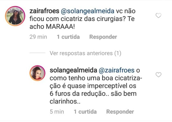 Solange Almeida explica ausência de marcas da cirurgia
