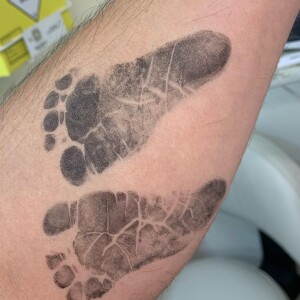 Os pés de Zoe ficaram marcados no antebraço de Duda Nagle