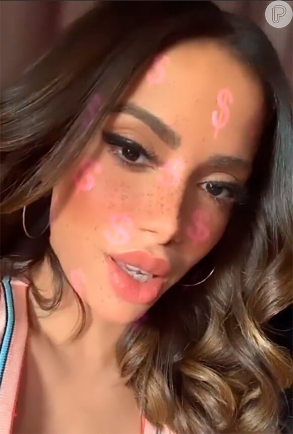 Anitta fez novo preenchimento labial inspirado em filtro do Instagram