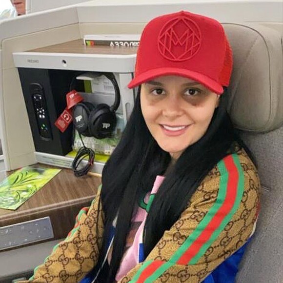 Maraisa mostra rosto ainda em recuperação de cirurgia plástica no nariz