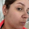 Marília Mendonça mostra rosto uma mês após nascimento do filho, Léo, e tratamento
