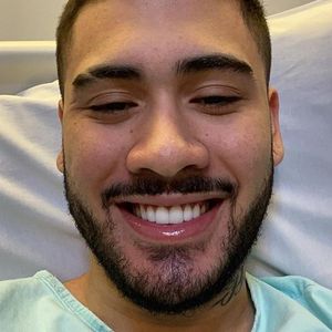 Kevinho mostra antes e depois de rinoplastia