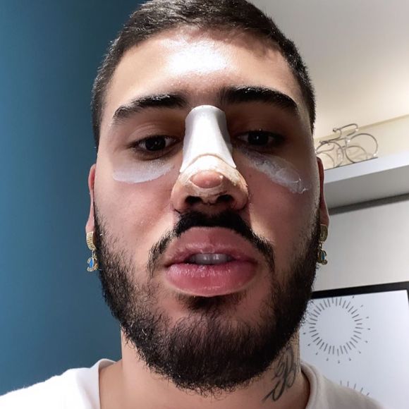 Kevinho revela que também mexeu na aparência do nariz: 'Eu também aproveitei para dar uma mexida na estética porque minhas alas eram bem abertas'