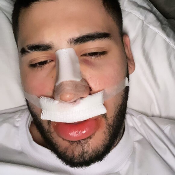Kevinho mostra foto do primeiro dia após cirurgia plástica no nariz