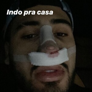 Kevinho mostra momento em que deixou a clínica após plástica no nariz