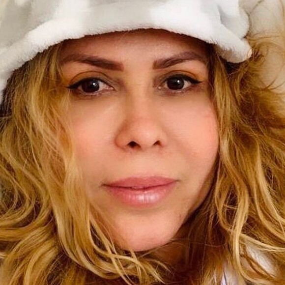 Joelma contou que o Coronavírus deixou sequelas em seu corpo