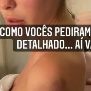Bárbara Evans explica braços doloridos: 'Tive que aplicar a injeção para não ter trombose'