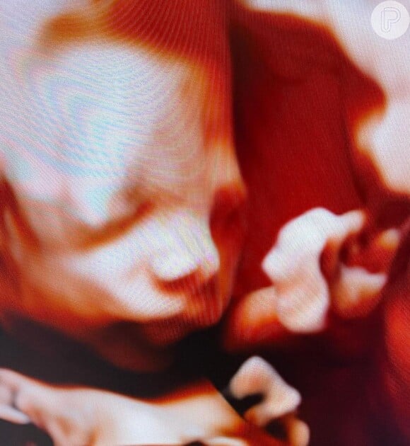 Grávida de 1ª filha com Zé Felipe, Virgínia postou ultrassom 3D no Instagram