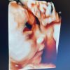 Virgínia Fonseca compartilhou foto do ultrassom da filha, Maria Alice