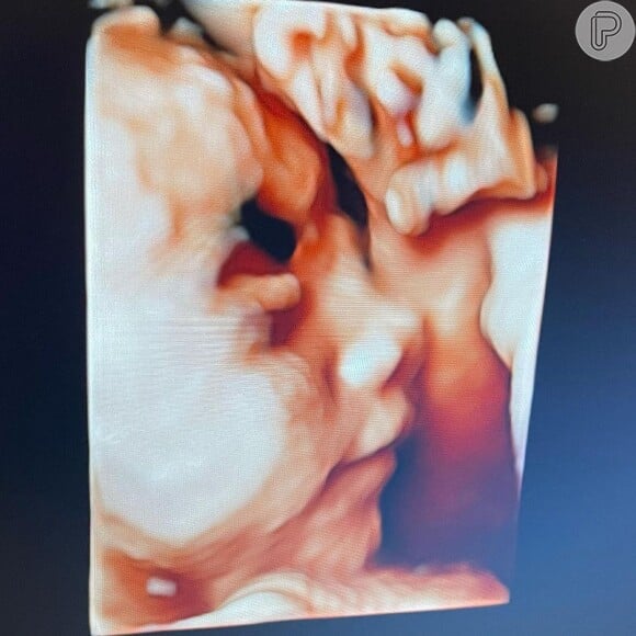 Virgínia Fonseca compartilhou foto do ultrassom da filha, Maria Alice