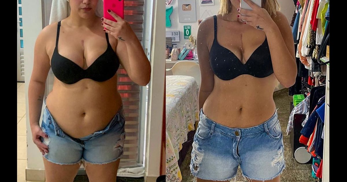 Jéssica Costa Mostrou Seu Antes E Depois Na Web Purepeople