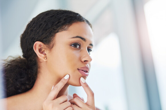 Skin Glow pode ser realizado em peles com acne: especialista indica detalhes do tratamento para pele mais iluminada