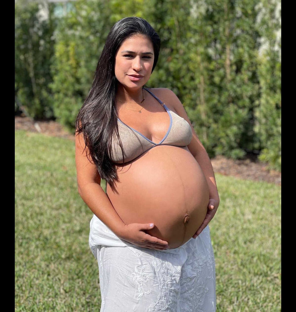 Simone mostra resultado de abdominoplastia em foto de biquíni - Zoeira -  Diário do Nordeste