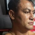 Popó tatuou a luta contra Whindersson Nunes