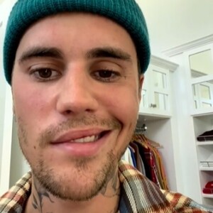 Por causa da síndrome, Justin Bieber não consegue mover metade de seu rosto