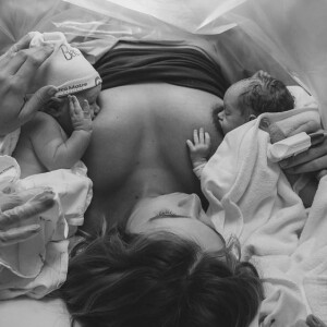 Filhos gêmeos de Isabella Scherer aparecem sendo amamentados na mesa de parto em foto publicada pela atriz